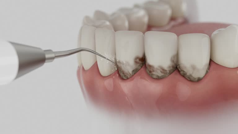Reliable Emergency Dentist contractor in San Mateo, CA by Smile Center Dentistry